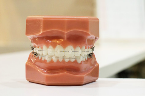 矯正歯科の画像